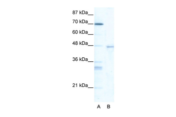 HSF4 Rabbit Polyclonal Antibody