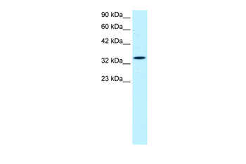 SMAD6 Rabbit Polyclonal Antibody