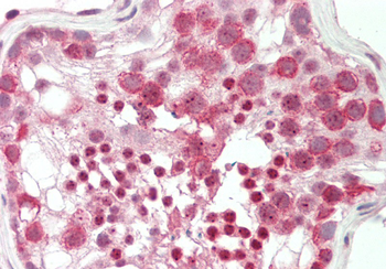 MBD1 Rabbit Polyclonal Antibody