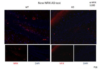 NFIX Rabbit Polyclonal Antibody