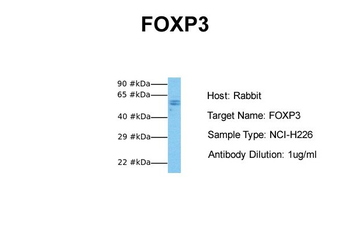FOXP3 Rabbit Polyclonal Antibody