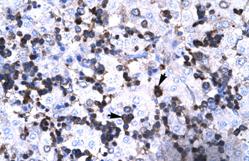 FOXP3 Rabbit Polyclonal Antibody