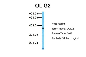 OLIG2 Rabbit Polyclonal Antibody