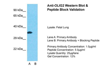 OLIG2 Rabbit Polyclonal Antibody