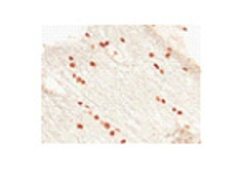 OLIG2 Rabbit Polyclonal Antibody