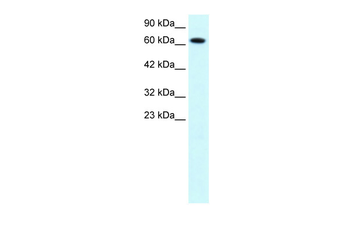 PIAS3 Rabbit Polyclonal Antibody