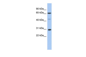 PIAS3 Rabbit Polyclonal Antibody