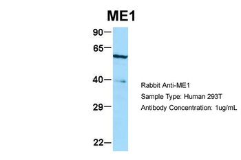 ME1 Rabbit Polyclonal Antibody