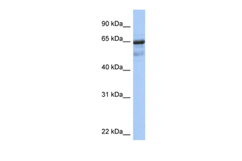 PCK1 Rabbit Polyclonal Antibody
