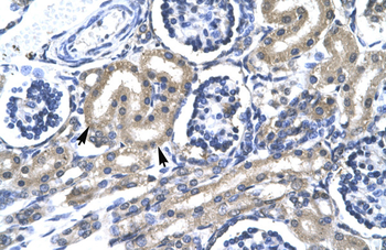 TRAFD1 Rabbit Polyclonal Antibody