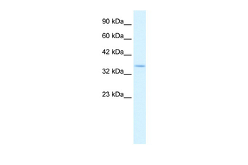 COPS5 Rabbit Polyclonal Antibody