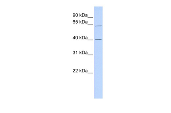 TRIT1 Rabbit Polyclonal Antibody