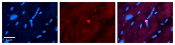 APTX Rabbit Polyclonal Antibody