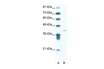 HIF1AN Rabbit Polyclonal Antibody