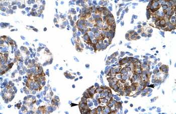 BARX1 Rabbit Polyclonal Antibody