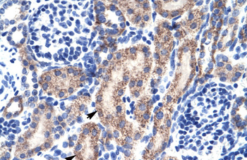 RBAK Rabbit Polyclonal Antibody