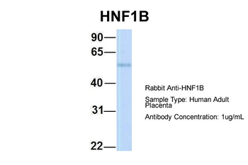 HNF1B Rabbit Polyclonal Antibody