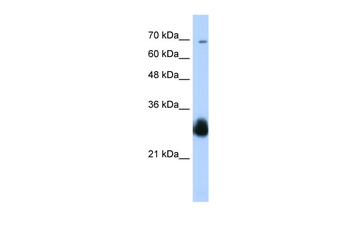RNF138 Rabbit Polyclonal Antibody