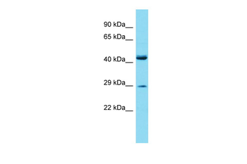 Prrx2 Rabbit Polyclonal Antibody