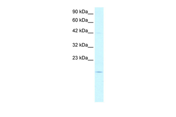 PFDN1 Rabbit Polyclonal Antibody