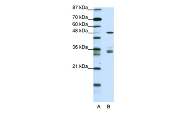 PHF1 Rabbit Polyclonal Antibody