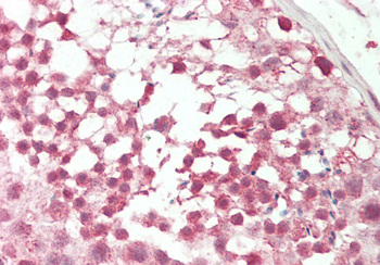 Pou3f1 Rabbit Polyclonal Antibody