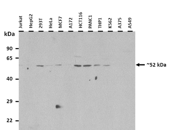 PPARA Rabbit Polyclonal Antibody