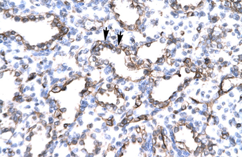 ENG Rabbit Polyclonal Antibody