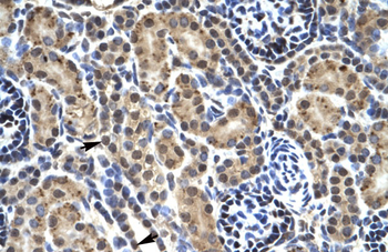 PHKG2 Rabbit Polyclonal Antibody