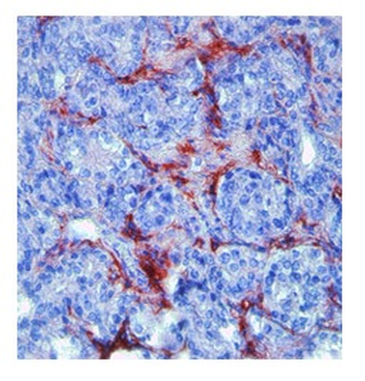 MMP9 Rabbit Polyclonal Antibody