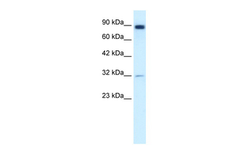 MMP9 Rabbit Polyclonal Antibody
