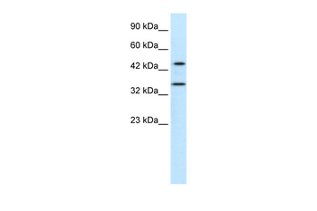 PNMA1 Rabbit Polyclonal Antibody