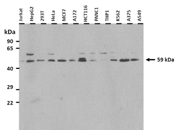 GPR75 Rabbit Polyclonal Antibody