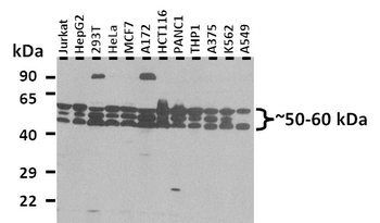 GPR75 Rabbit Polyclonal Antibody