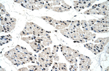 RALY Rabbit Polyclonal Antibody