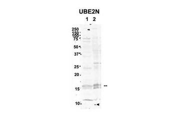 UBE2N Rabbit Polyclonal Antibody