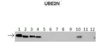 UBE2N Rabbit Polyclonal Antibody