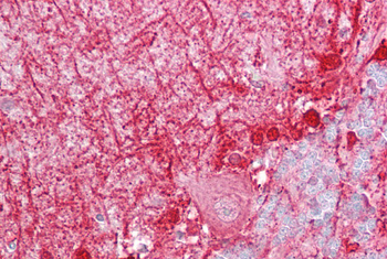 DBI Rabbit Polyclonal Antibody