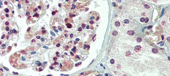 TBX20 Rabbit Polyclonal Antibody