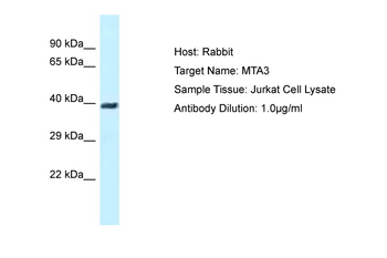 MTA1 Rabbit Polyclonal Antibody
