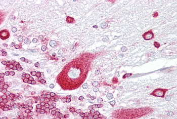 PURA Rabbit Polyclonal Antibody
