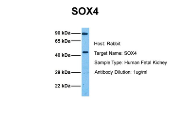SOX4 Rabbit Polyclonal Antibody
