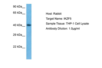 IKZF5 Rabbit Polyclonal Antibody