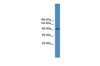ZNF574 Rabbit Polyclonal Antibody
