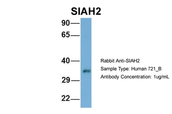 SIAH2 Rabbit Polyclonal Antibody