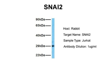 SNAI2 Rabbit Polyclonal Antibody