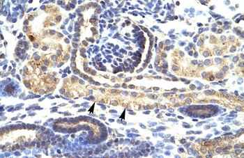 SNAI1 Rabbit Polyclonal Antibody