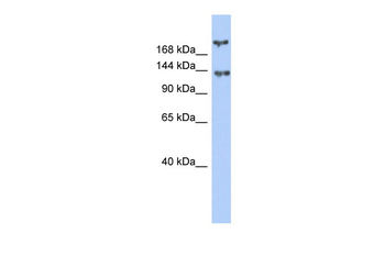 BRCA1 Rabbit Polyclonal Antibody