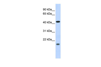 ING3 Rabbit Polyclonal Antibody