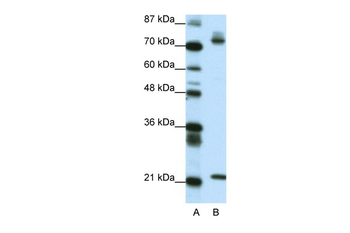 SATB1 Rabbit Polyclonal Antibody